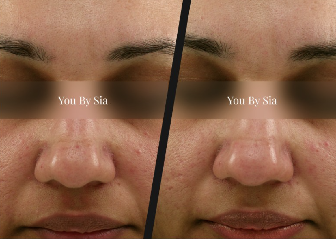 Before and after — You By Sia client