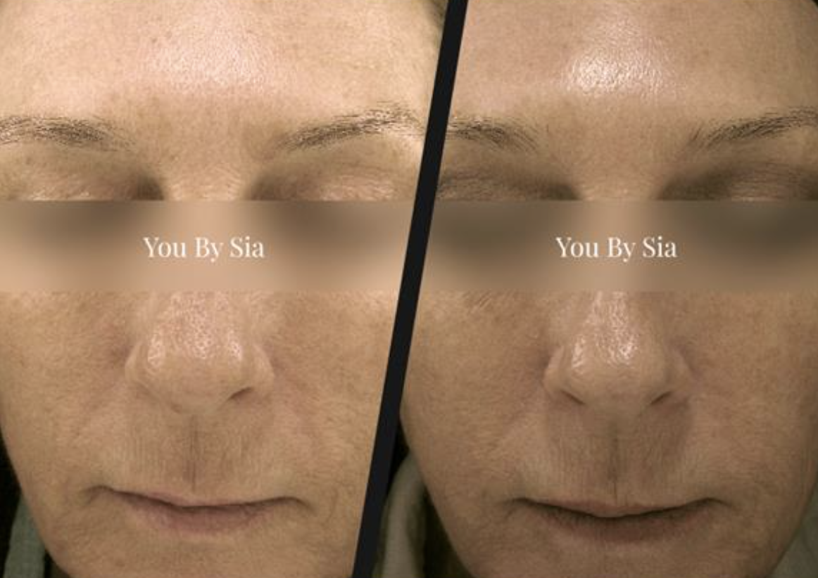 Before and after — You By Sia client