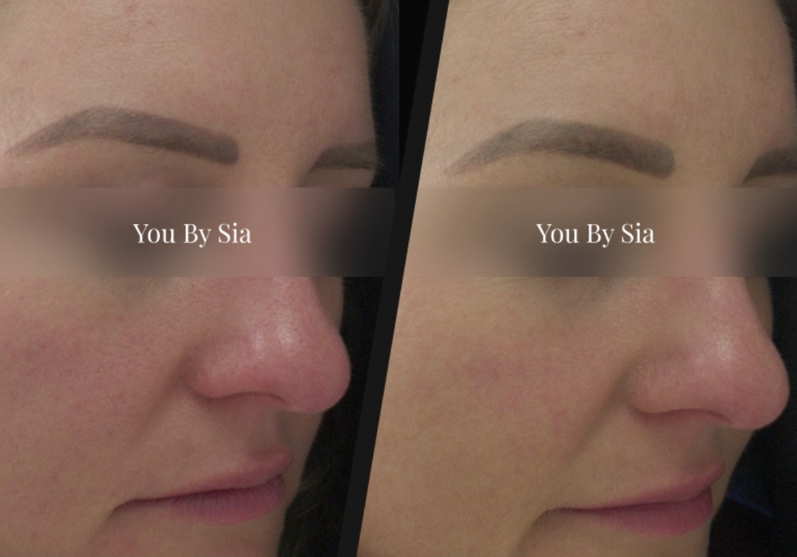 Before and after — You By Sia client