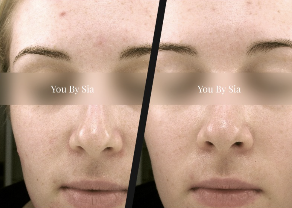 Before and after — You By Sia client